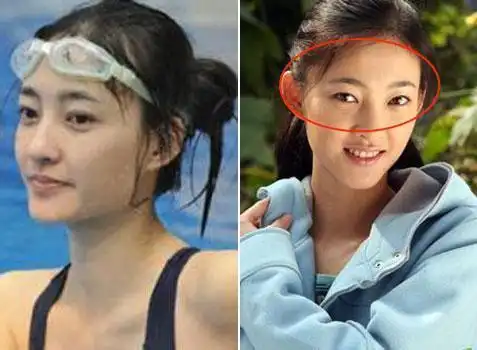 王丽坤整容前后对比照.