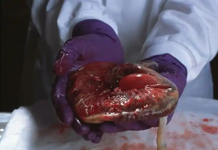 产妇分娩后,胎盘一般有四种去向,有种去向对人体好处多多