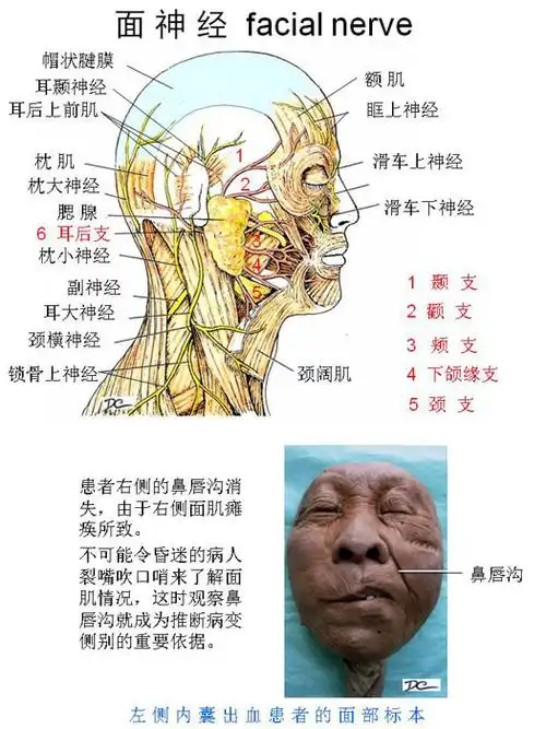 周围神经系-面神经
