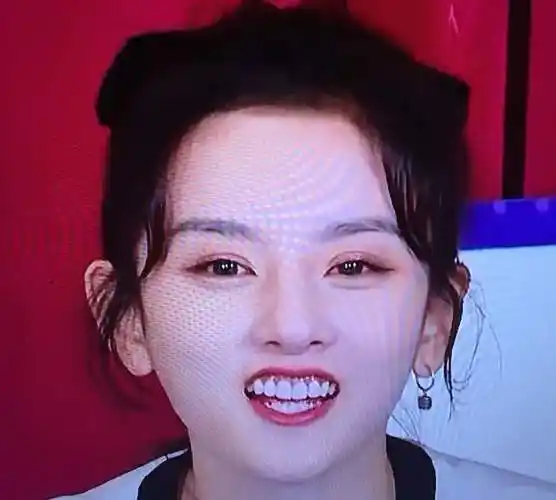 女神杀手烤瓷牙宋祖儿颜值也崩了只因学了迪丽热巴去动牙