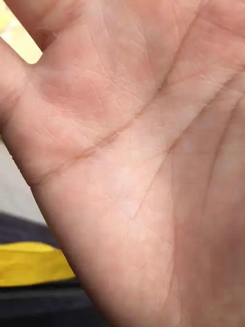 看我手相月丘上是星号吗?