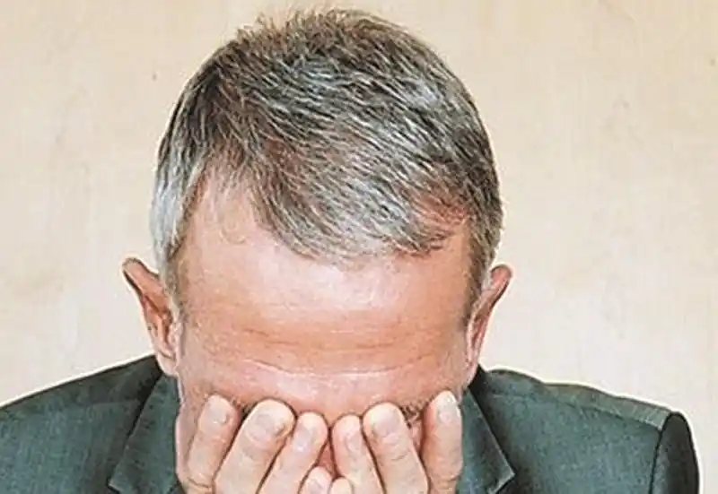 治白发,男女老少有区别