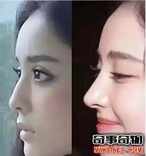 古力娜扎整容前后照片对比 到底是真的整容了还是被网友黑的呢