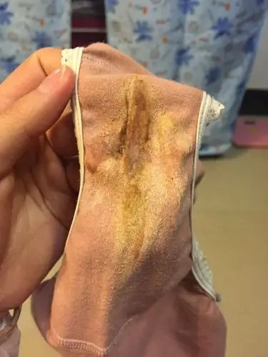 白带怎么这样啊?