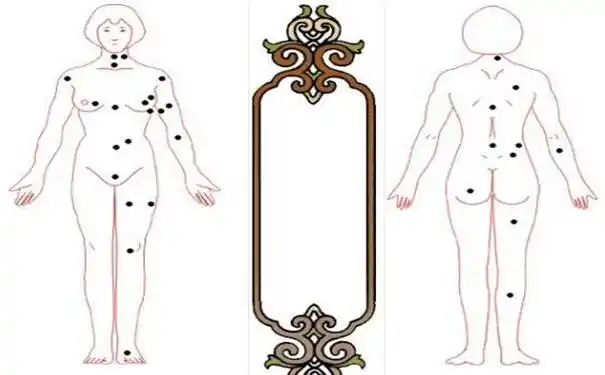 体痣相这些痣相会给人带来霉运