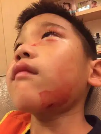 美女名嘴5岁儿暴雨天受伤 「满脸血」送急诊!