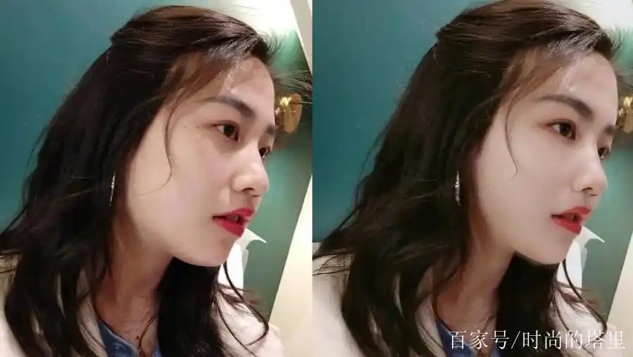 胖人瘦下来鼻子变化