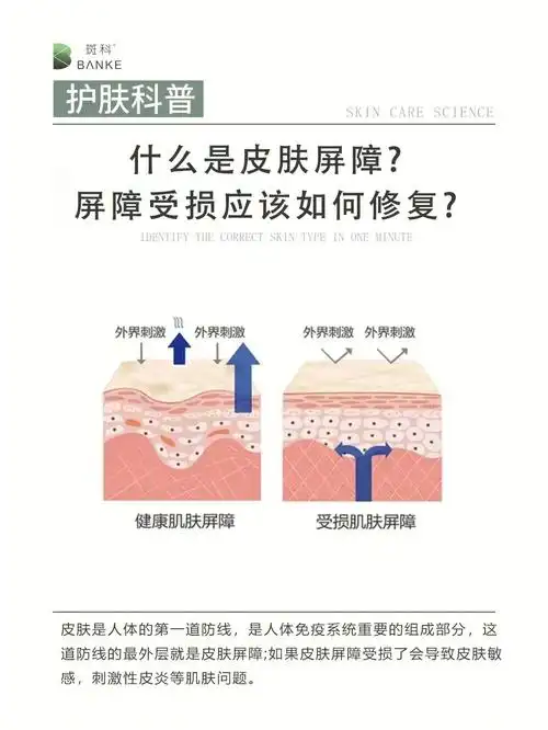 科普什么是皮肤屏障屏障受损如何修复