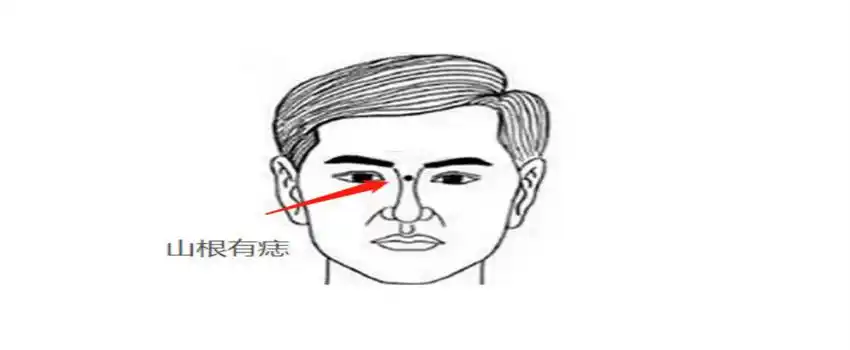 山根有痣是好还是不好(不好) - 匠子生活