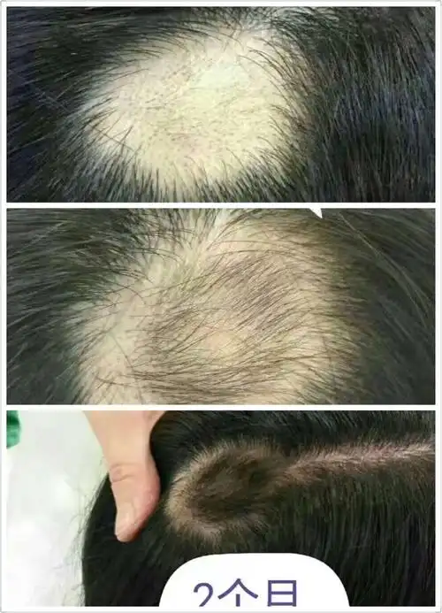 我的美篇 - 美篇