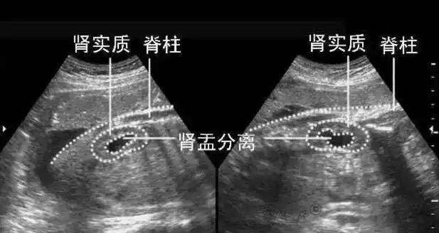 准妈妈们知道医生是如何通过b超单鉴定胎儿性别的吗get起来