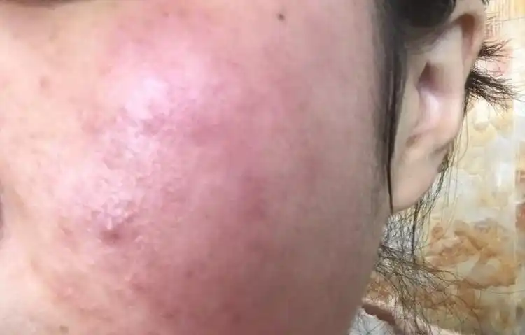 你是啥类型的敏感肌4组测试就知道快来测测