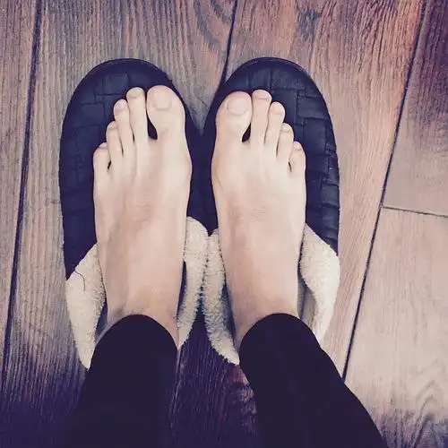 这是不是所谓的希腊脚