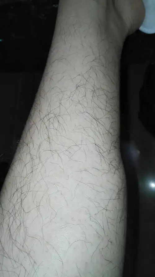 腿毛即使剃了也是有黑黑的根部残留,我皮肤还挺白的,看过去就是满腿