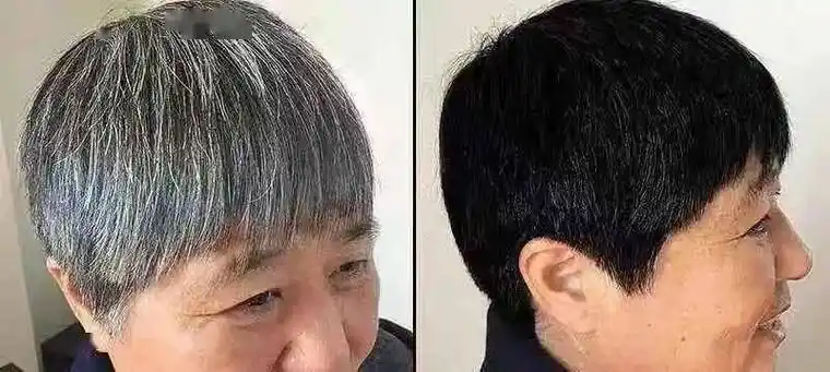 白头发千万别去店里染这样白发变黑发简单又健康年轻又漂亮