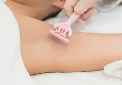 腋毛可以用镊子拔吗 用镊子拔腋毛好吗