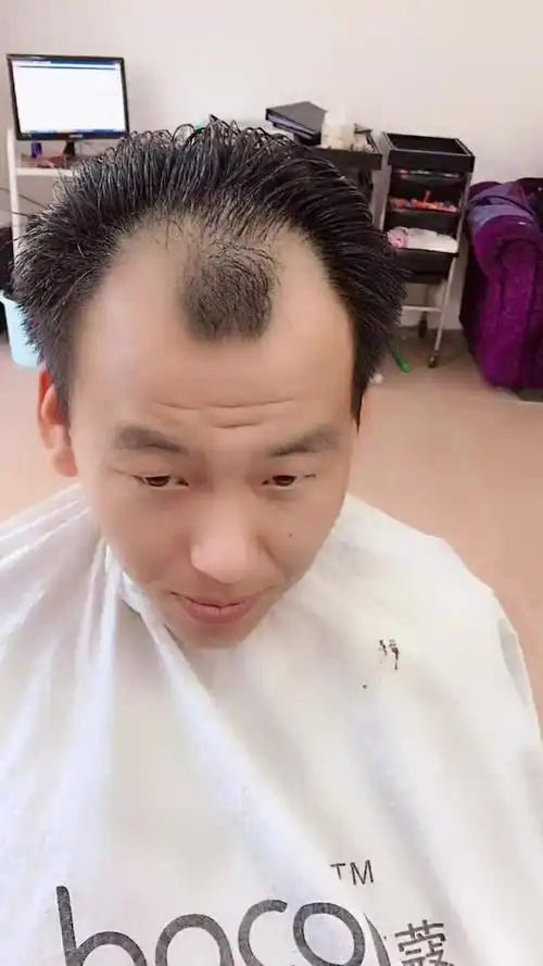 两边秃不要紧,这个发型适合你