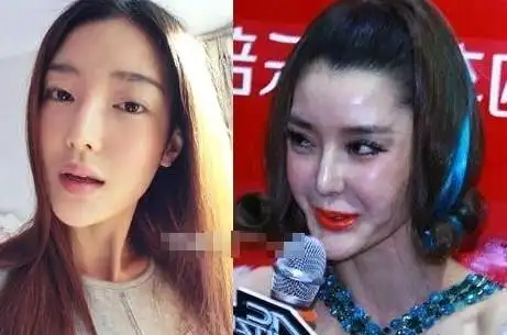 整容失败女星大盘点,郑爽张檬可惜,她不人不鬼,最后一位成怪物