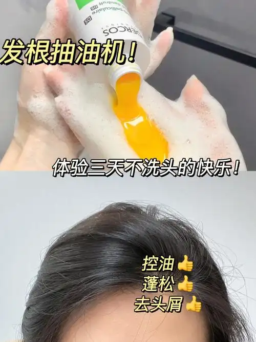 头发终于清爽干净了夏天控油止痒服它