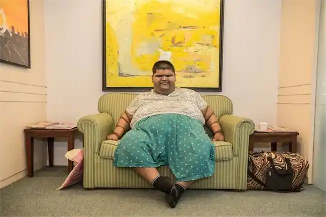 14岁474斤被称为世界上最胖的孩子胖到眼睛都睁不开