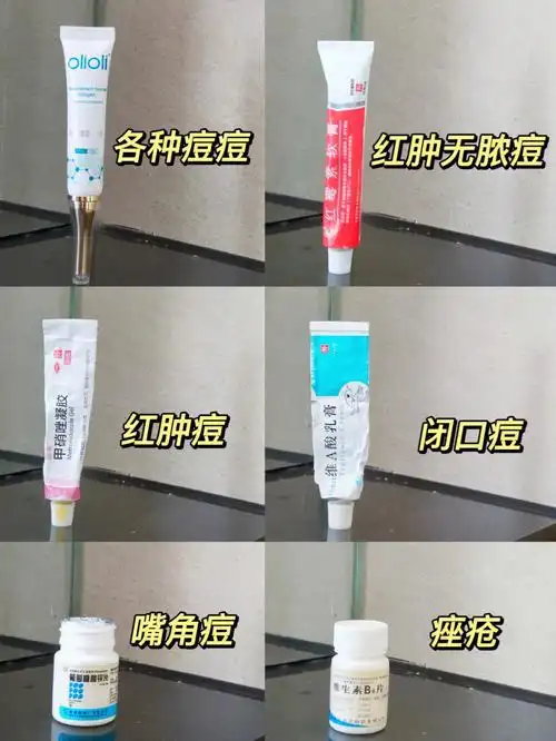 一堆祛痘药膏药片产品自用测评