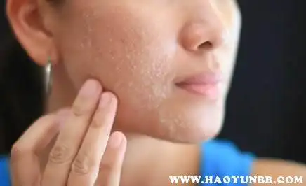 角质太厚的人脸部图片-好运宝贝