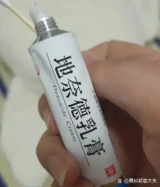 阴茎溃疡可以用这些药膏治疗: