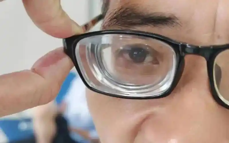 3000度超高度近视 白内障,华厦眼科张晓山院长医术高超复光明_陈叔