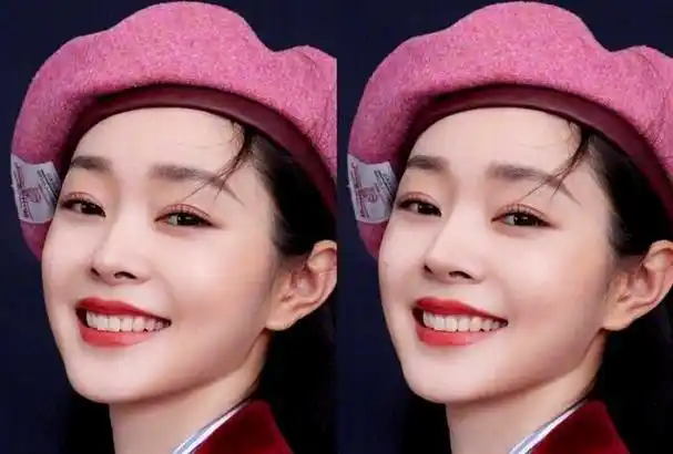 为何宋轶的塌鼻梁不影响美感?