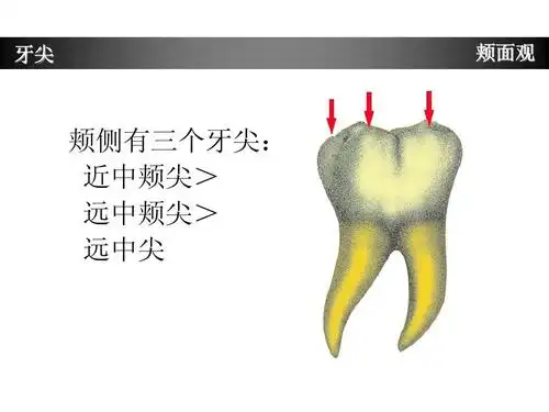下颌第一磨牙牙体形态简述ppt