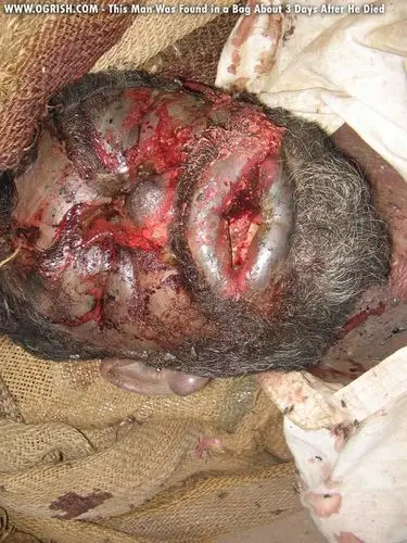 尸体腐烂过程配图详解(先声明啊一定慎入)