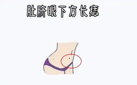 肚脐左上方有痣男(肚脐左上方有痣男人好不好)