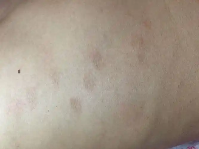 最近发现身上长了一些像癣一样的东西,不疼不痒,求医生帮我看下
