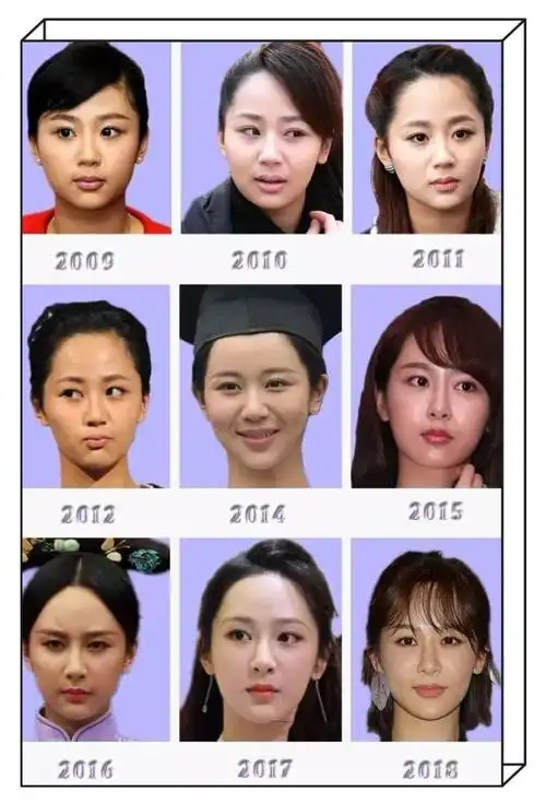 杨紫整容了吗(杨紫整容史)_可可情感网