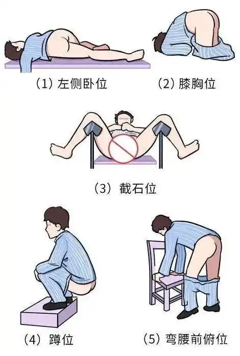 而psa筛查只需抽血检查,更加方便,痛苦感更小.