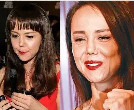 盘点娱乐圈中整容失败的明星,真是让人不忍直视!