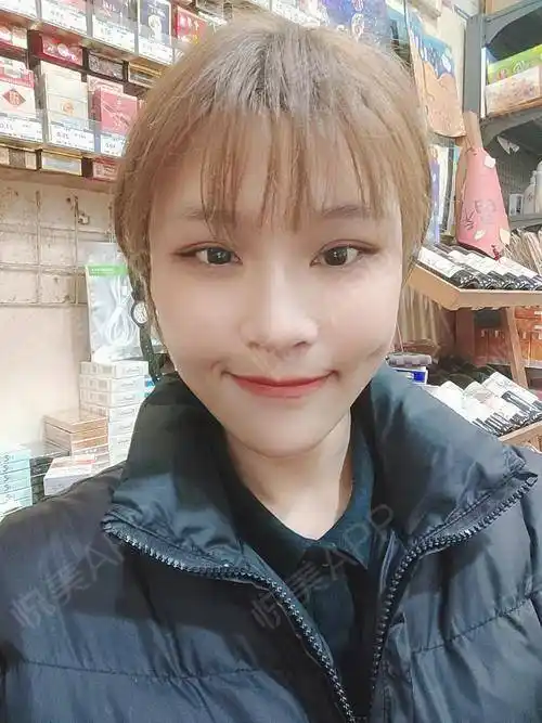 时间过得真快,做完自体脂肪填充已经快半个月啦,目前恢复得很好,槐揪