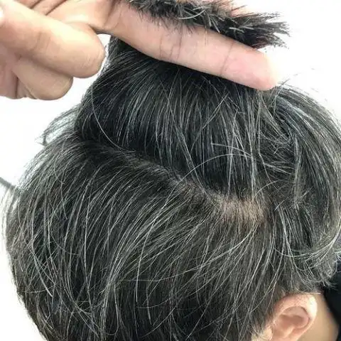 如果你仔细观察过一根白发,就会发现,"白发"并不是白色,而是透明的.