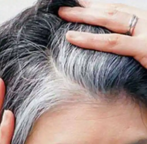 白头发的原因为什么会出现白发