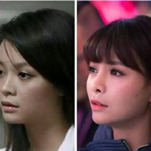 9696沈梦辰的整容事迹在娱乐圈里也算是教科书级别的了_圈子-新氧