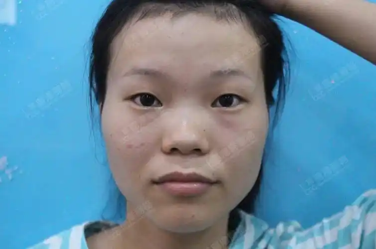 鼻梁塌女人_鼻梁塌鼻子大女人_塌鼻梁大鼻子女生面相