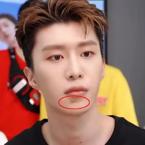 原创曝范丞丞洗澡摔脸致俊面出沟他直播回应滤镜难遮伤口