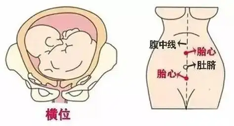 当然了,根据胎心的位置只能大概了解宝宝的胎位,如果想要确定宝宝的
