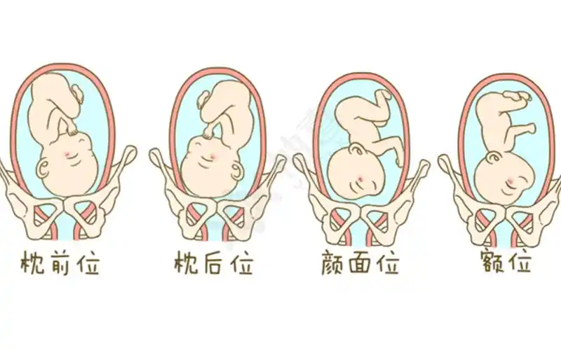 其中头位又分为左枕前位loa和右枕前位roa,因此胎位roa属于头位的一种