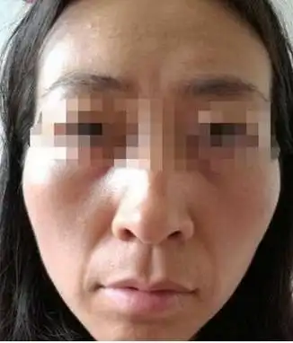 这种面相的女人,注定是一辈子的劳碌命,克夫又败运