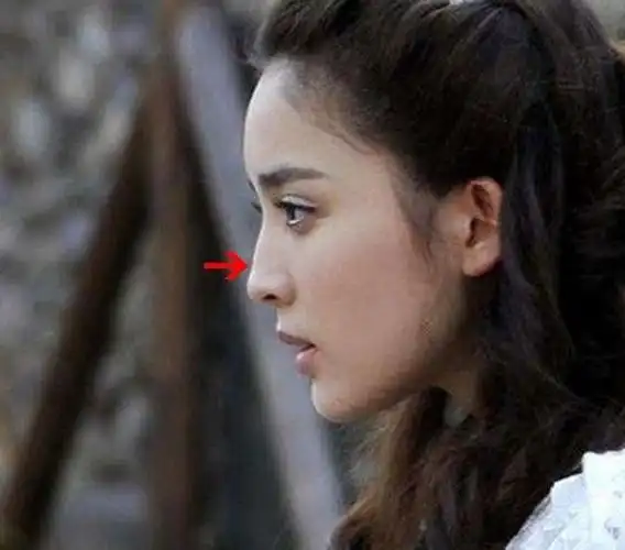 张翰娜扎疑闹分手,难道是因为娜扎把驼峰鼻磨平了不再纯天然?