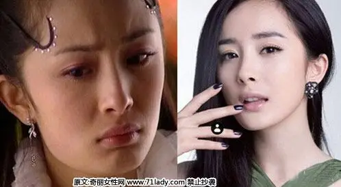 杨幂整容前后照片对比吓人 没整容谁会相信?
