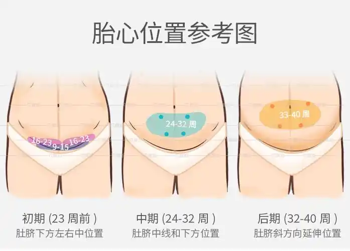 胎心监护仪孕妇家用充电胎心仪检测仪胎心监测仪听诊器h5-w 【套餐