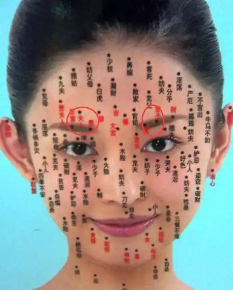 这痣可不是一般的大富大贵痣,所以称为石崇巨富痣,石崇是西晋时期的