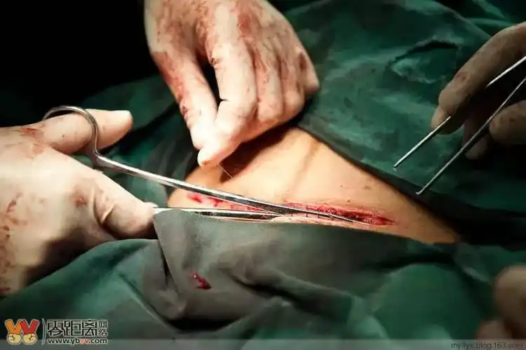 100张剖腹产过程照片男人们多给你的女人一点关怀吧